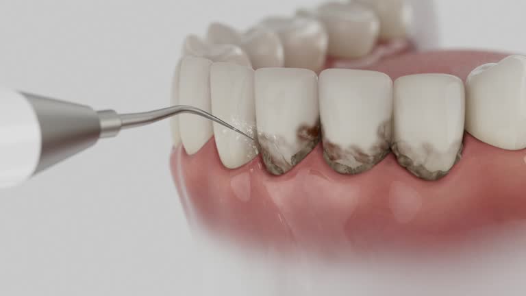 Trusted Teeth Cleaning And Checkup service in Fayetteville, TN - Dentist Open Now